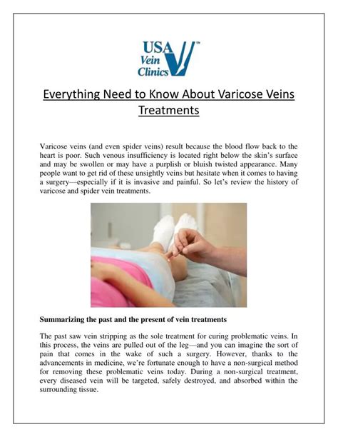 Ppt Everything Need To Know About Varicose Veins Treatments