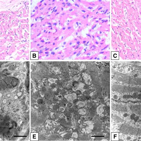 H E Staining Showing The Pathological Changes In Myocardial Tissues Of