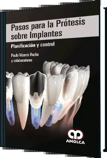 Pasos para la Prótesis Sobre Implantes