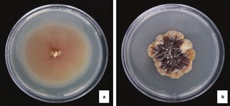 Colonies On Sda A And Pda B Plates Cultured At C For Month