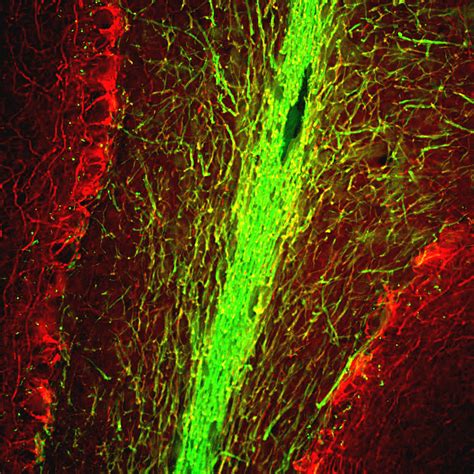 Anti Myelin Basic Protein D Arg Arigobio