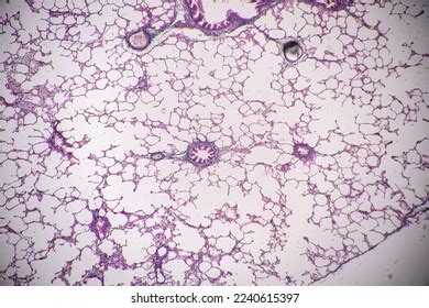 632 Pituitary Gland Stock Photos, Images & Photography | Shutterstock