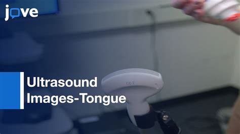 Ultrasound Images Tongue Assessment Remediation Of Speech Sound