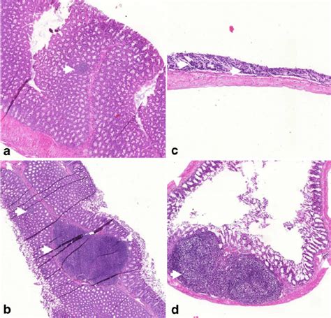 Isolated Lymphoid Follicles And Lymphoid Aggregates In The Dss Induced Download Scientific