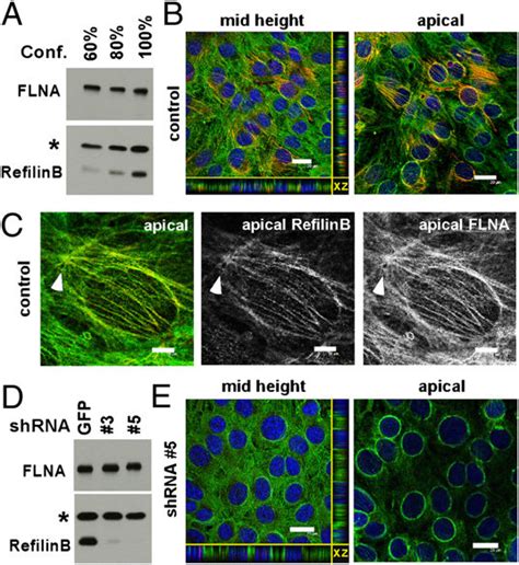 RefilinB promotes the recruitment of FLNA on perinuclear actin cap in ... 