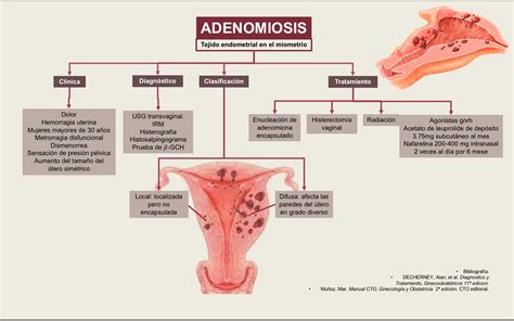 Blog De Evidencias De La Materia De GinecologÍa Y Obstetricia Endometriosis Y Adenomiosis