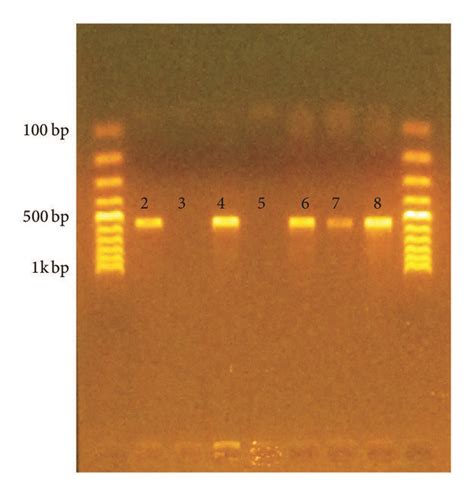 Gel Electrophoresis Showing The Pcr Products Lane And Lane Dna