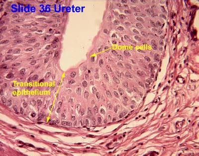 Transitional epithelium - Wikipedia