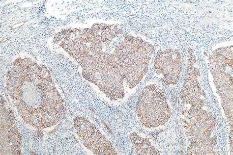 Ihceasy Beta Catenin Ready To Use Ihc Kit United Bio Research