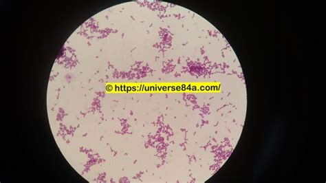 Streptococcus Oralis Introduction Morphology Pathogenicity Lab