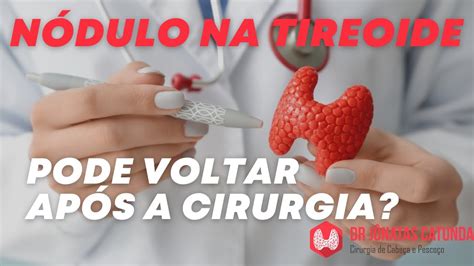 Nódulo na tireoide pode voltar após a tireoidectomia total YouTube