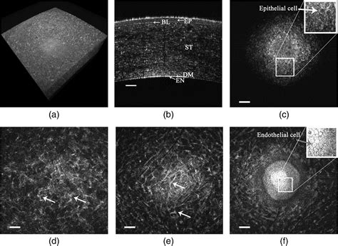 Unbiased Corneal Tissue Analysis Using Gabor Domain Optical Coherence