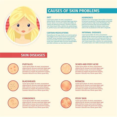 Infographics Van Huidproblemen De Oorzaken Van Een Probleemhuid