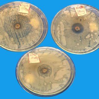 Photo macrograph of the culture plates showing bacteria growth... | Download Scientific Diagram