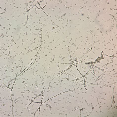 Yeast Budding And Hyphae Medlabbuddy