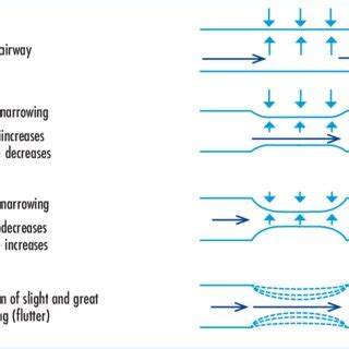 (PDF) Wheeze