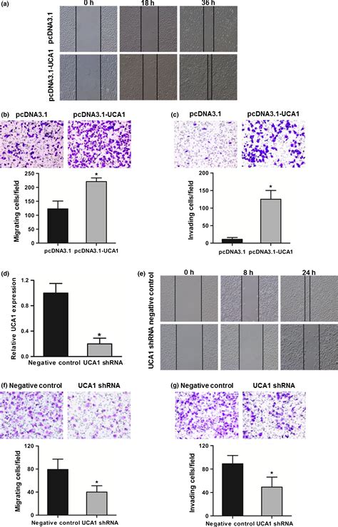 Long Noncoding Rna Urothelial Cancerassociated Promotes Bladder