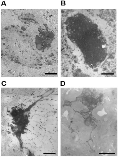 Representative Microphotographs Of Necrotic Human Nucleus Pulposus