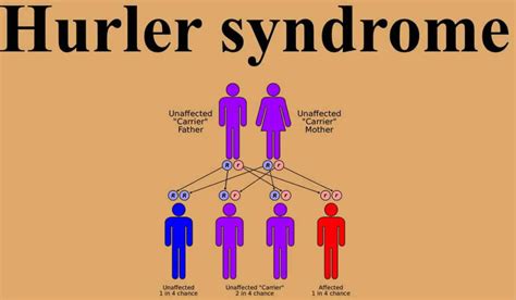 Hurler Syndrome Causes Symptoms Diagnosis Treatment And Life Expectancy