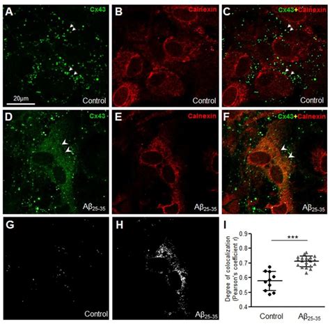 Aβ 25 35 Increases Cx43 Localization In The Endoplasmic Reticulum