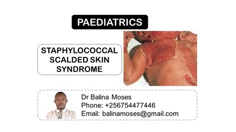 Staphylococcal Scalded Skin Syndrome Ssss Youtube