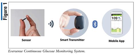 Eversense Continuous Glucose Monitoring System