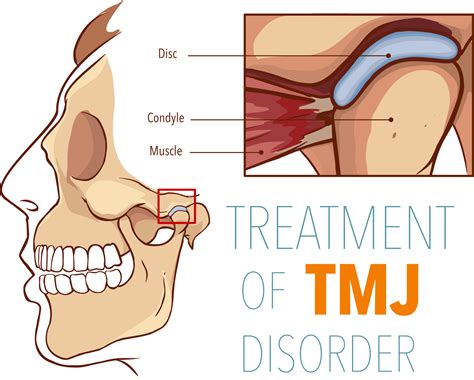 Lethbridge Jaw Pain Therapy for TMJ Disorder — Peak Dental - Logo