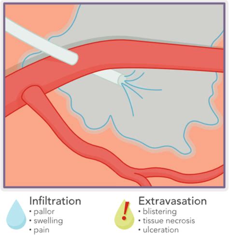 Ati Dosage Calculation And Safe Medication Administration