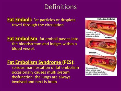 Ppt Fat Embolism Syndrome Powerpoint Presentation Free Download Id