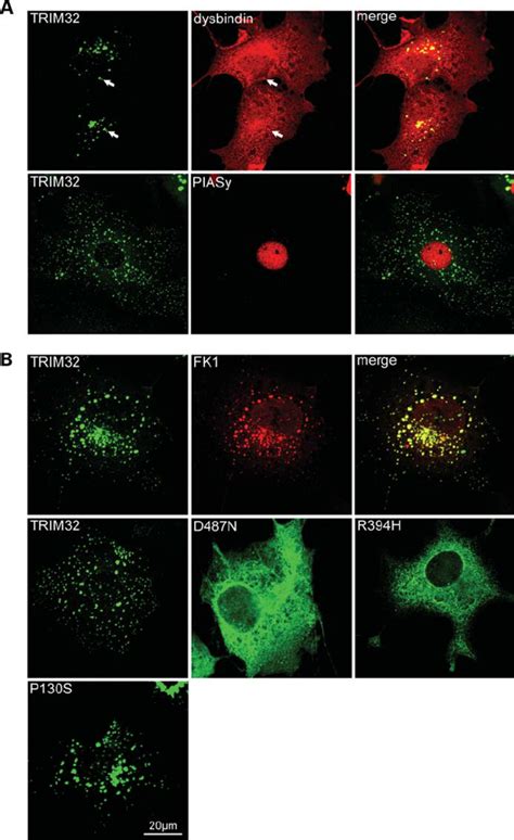 Subcellular Distribution Of Trim Dysbindin And Piasy In Cos Cells