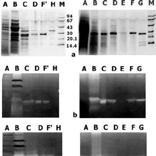 Sds Page A And Gelatin B And Casein C Zymography Analysis Of The