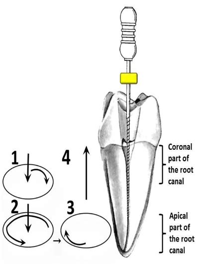 Fig 2 A Diagram Summarizing The Three Key Movements In The Balanced