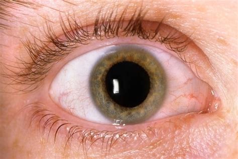 5 Pruebas Para Identificar El Glaucoma Tua Saúde