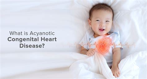 What Is Acyanotic Congenital Heart Disease Eternal Hospital