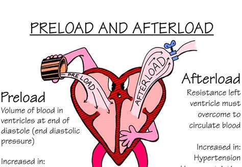 Nursing Mnemonics: Preload vs Afterload - StudyPK