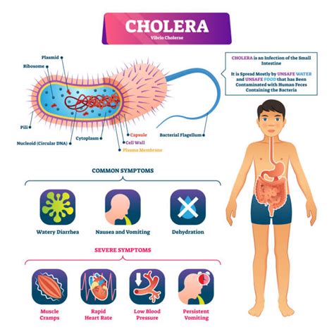 2,500+ Cholera Bacteria Stock Photos, Pictures & Royalty-Free Images - iStock