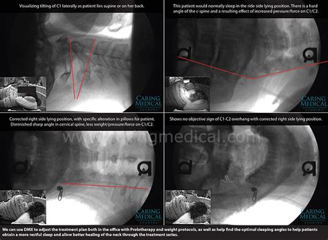 What is the cpt code soft tissue x-ray neck - koolopec