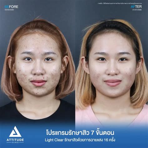 สาขาทั้งหมดของ Attitude Clinic คลินิกเสริมความงามที่ให้ความสำคัญกับ