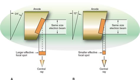 Exposure Factors X Ray Tube Assembly The Prime Factors Flashcards