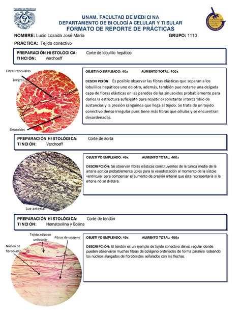 Cortes Histol Gicos De Tejido Conectivo Humano Unam Facultad De