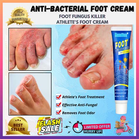 💯 Sumifun Foot Care Cream VERY AUTHENTIC SAFE GUARANTED AND EFFECTIVE ...