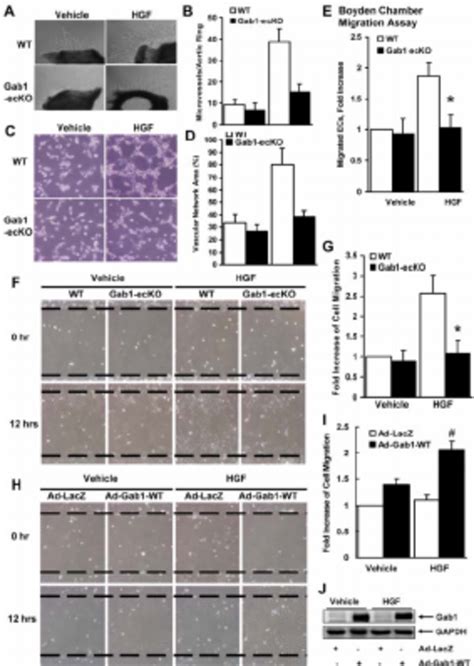 Gab1 Deficiency In ECs Impaired Microvessel Sprouting Tube Formation