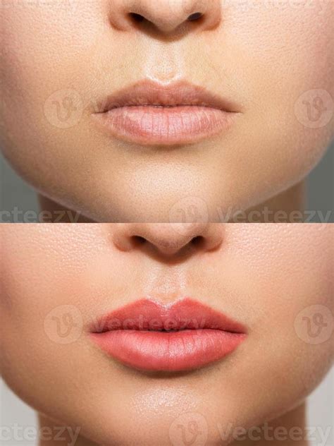 Female Lips After Permanent Makeup Lip Blushing Procedure 14346513