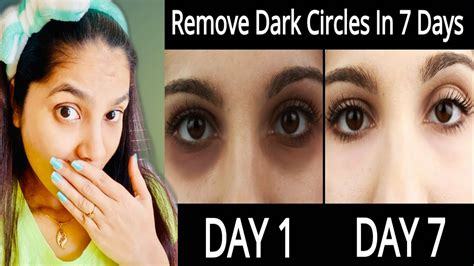 Dark Circle Kaise Hatayereduce Dark Circles Home Remedyआखों के काले