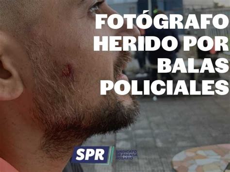 El SPR repudió la represión policial en el Gigante donde un fotógrafo