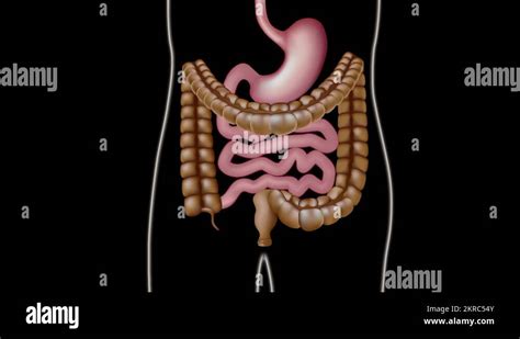 Colonoscopy procedure showing endoscope image Stock Video Footage - Alamy