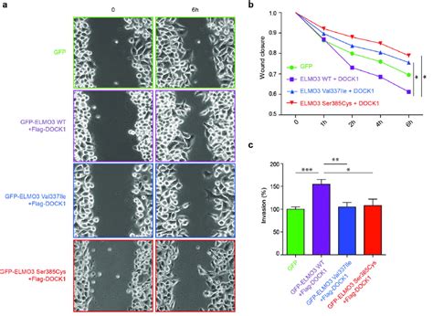 The Individual Patient Derived Elmo Mutations Impair Cell Migration