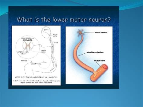 Motor Neuron Diseases Classification Lower Motor Neurons Disorders