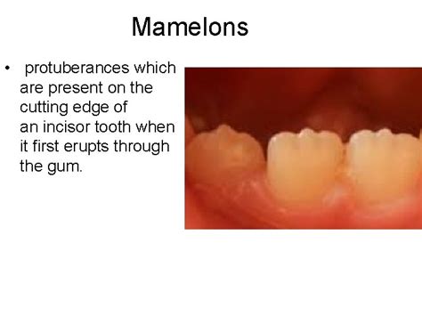 Pulp Cavities Of Permanent Teeth Tooth Structure Tooth