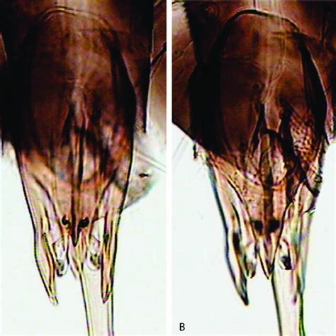 Trichogramma Alloeovirilia Cápsula Genital Ventral E Cápsula Genital Download Scientific